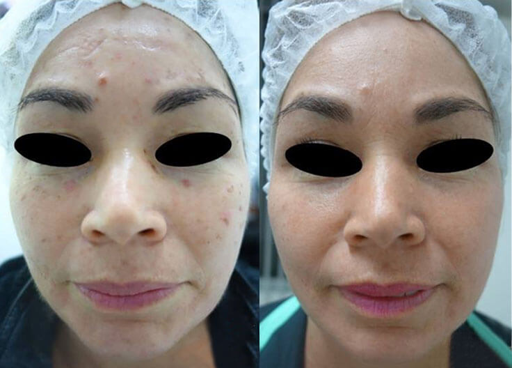 DERMATOLOGÍA QUIRÚRGICA 1