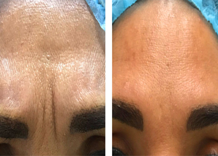 DERMATOLOGÍA QUIRÚRGICA 2