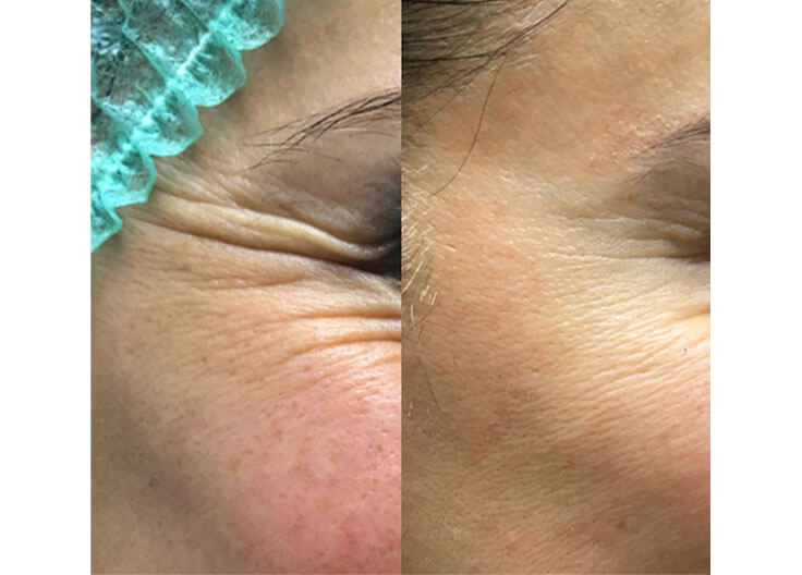 DERMATOLOGÍA QUIRÚRGICA 3