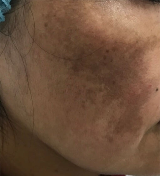 DERMATOLOGÍA QUIRÚRGICA 4