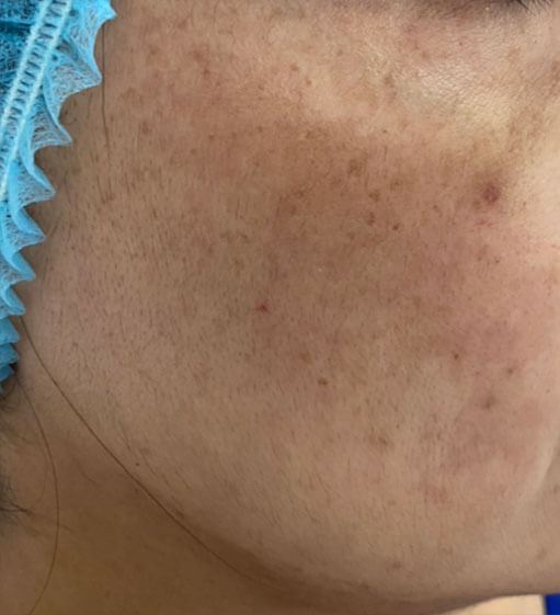 DERMATOLOGÍA QUIRÚRGICA 5