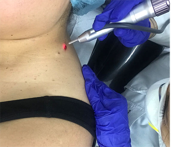 DERMATOLOGÍA QUIRÚRGICA 1
