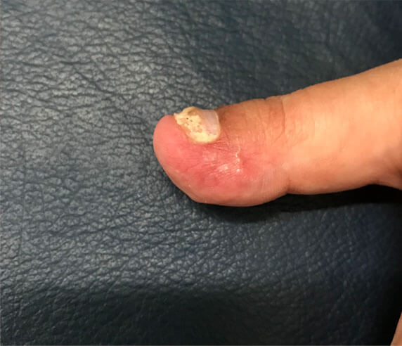 DERMATOLOGÍA QUIRÚRGICA 3