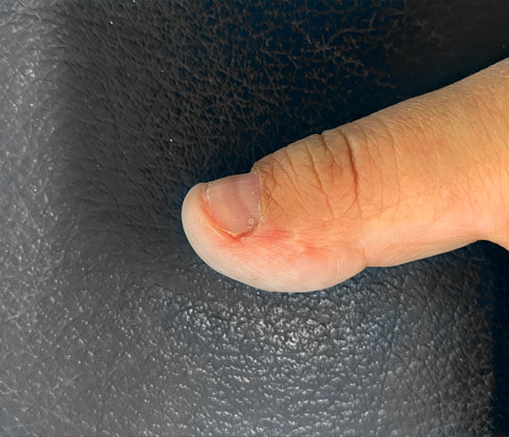 DERMATOLOGÍA QUIRÚRGICA 4